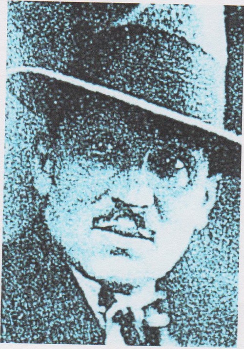 Zápal 1 001